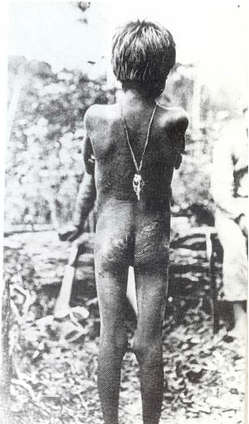 Un jeune Indien d'Amazonie dont le corps est couvert de cicatrices en raison des atrocités commises lors du boom du caoutchouc.