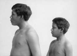 Omarino et Ricudo, deux esclaves witoto amenés au Royaume-Uni en 1911.