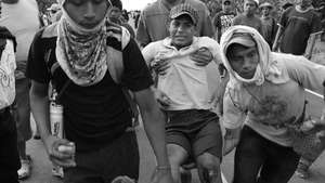 Herido2_300_wide
