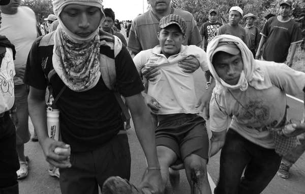 A Ngobe-Buglé boy is wounded after clashes with police in Panama