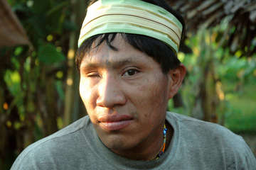 Jorge lost an eye during first contact