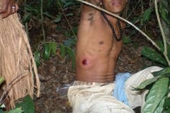 Un Tupinambá atteint par les tirs de la police lors d'une    précédente attaque en 2008.