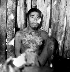 Indígenas achés poco después de ser capturados en el bosque y de ser llevados a la Reserva Aché. Paraguay, 1972.