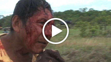 Makuxi-gunman-attack-thumb_460_wide_play