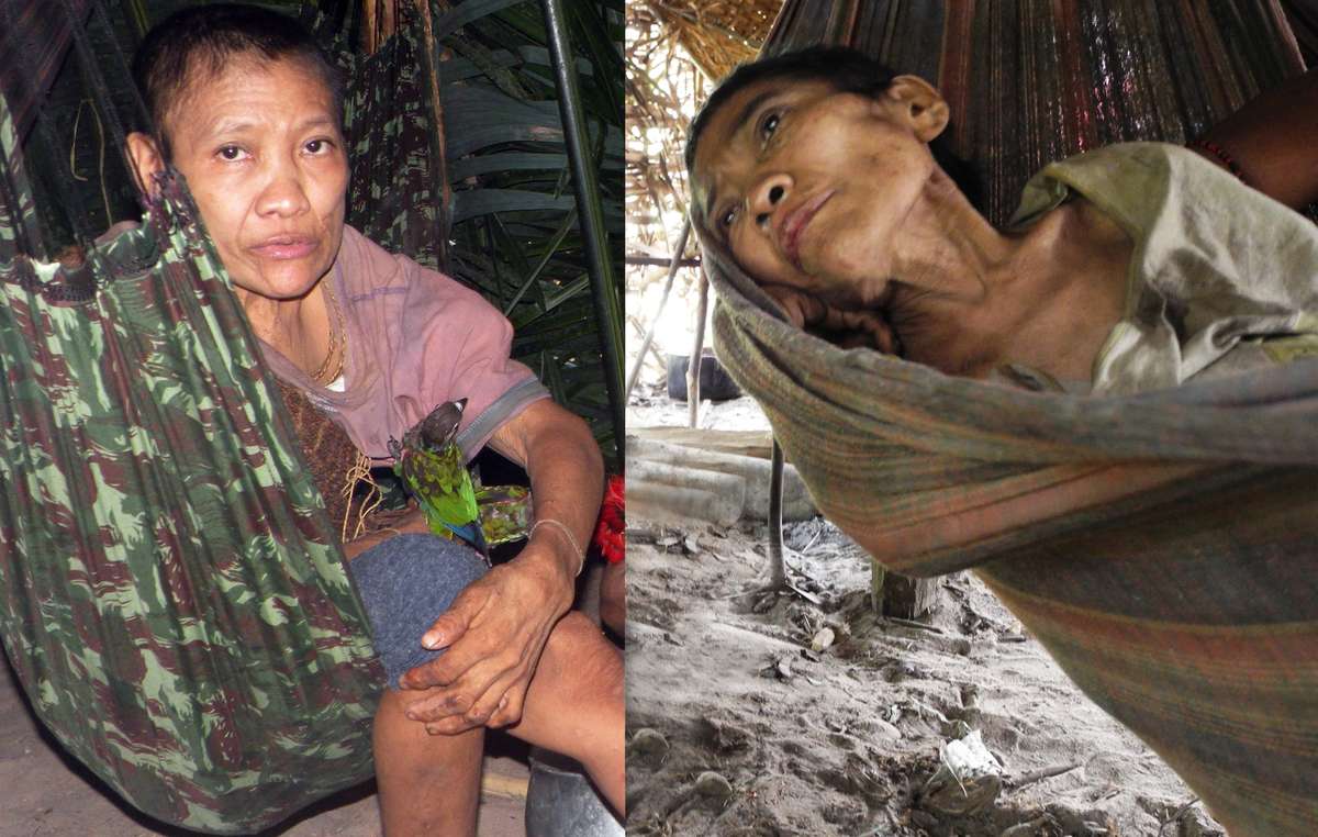 Jakarewyj, une femme awá, dont la santé s'est dramatiquement détériorée depuis que son groupe a été contacté en décembre dernier.