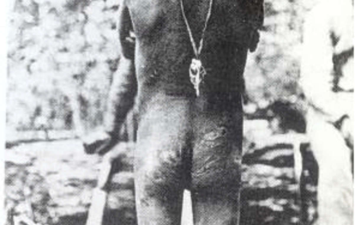 Un joven indígena amazónico con su cuerpo repleto de cicatrices fruto de las barbaridades cometidas durante la fiebre del caucho.