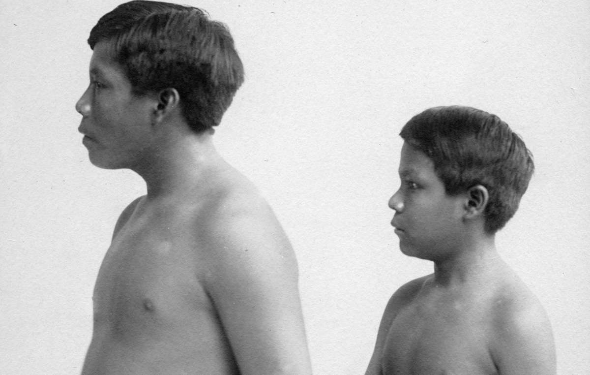 Die zwei Witoto Sklaven Omarino und Ricudo wurden 1911 nach Großbritannien gebracht.