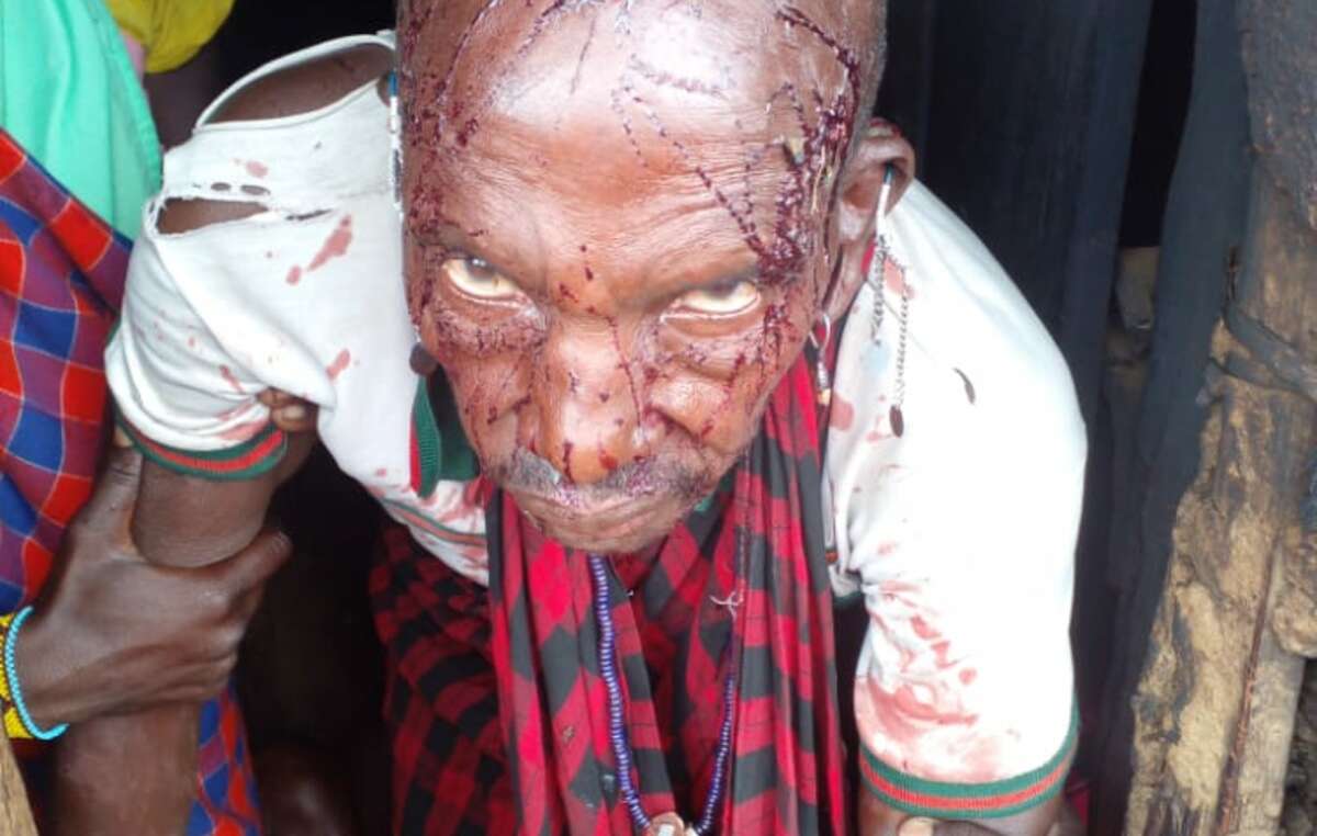 Anziano ferito durante l'attacco sferrato dall'esercito ai Masai che protestavano contro i tentativi di sfratto.