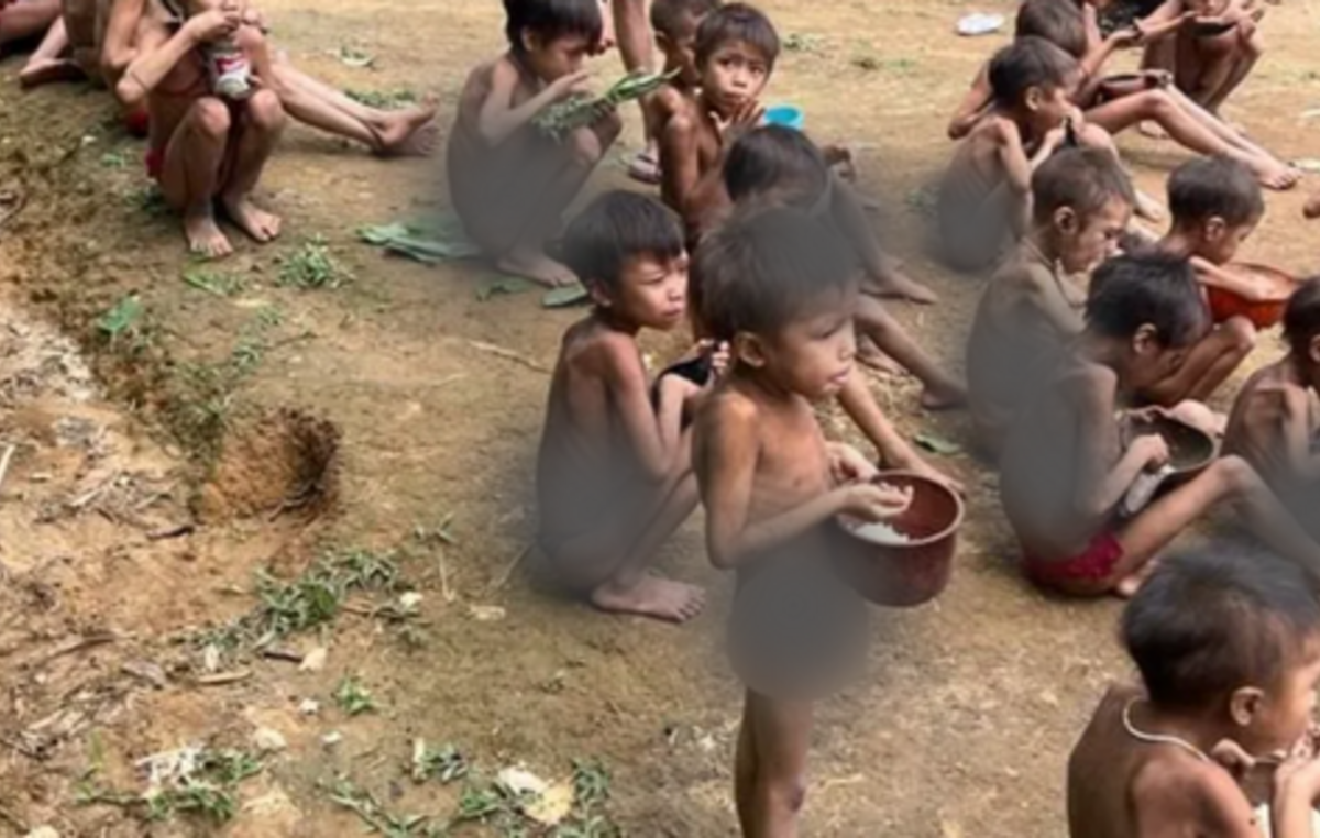 Crianças Yanomami severamente desnutridas, na região de Surucucus.