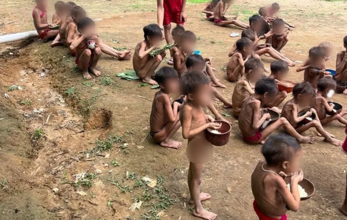 Niños yanomamis gravemente desnutridos, región de Surucucus.