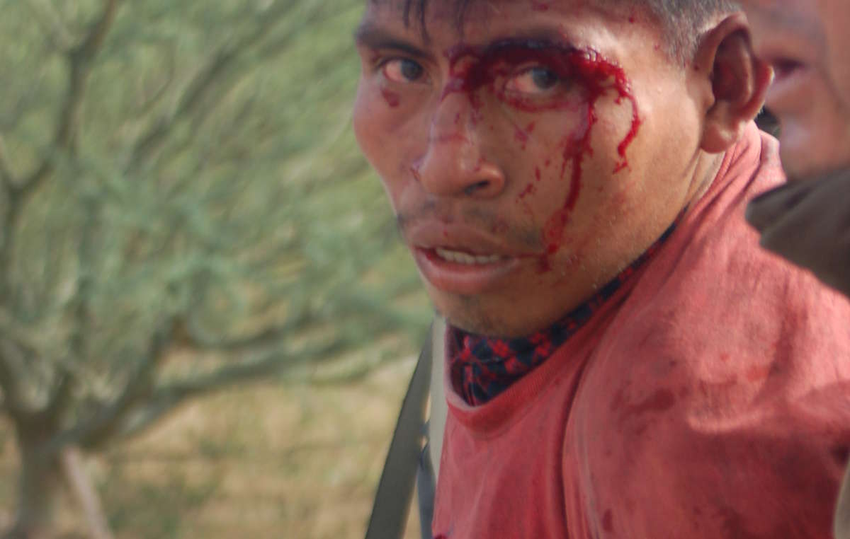 L’un des nombreux Indiens blessés à Bagua en état d’arrestation