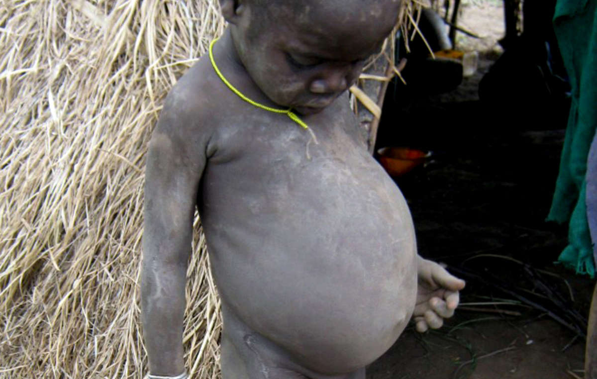 Un enfant kwegu devant sa maison. Les peuples de la vallée de l'Omo ne peuvent plus nourrir leurs enfants durant les périodes de sécheresse.