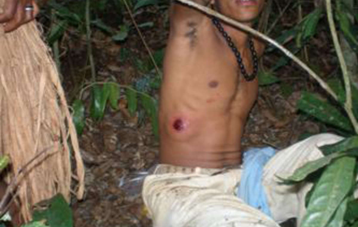 Un Tupinambá atteint par les tirs de la police lors d'une précédente attaque en 2008.